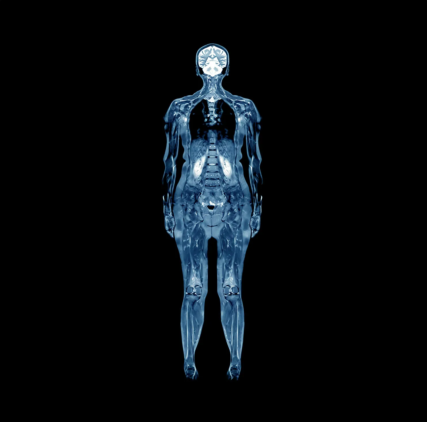 Full-body MRI scanner